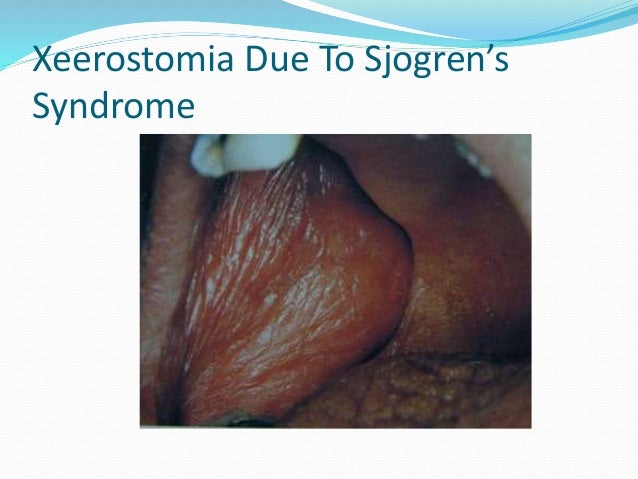 dry vagina syndrome Why do legs shake after sex